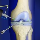 knee procedures