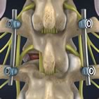 spine procedures surgical