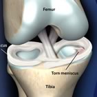 Knee Conditions