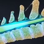 Spine Procedures (Non-Surgical)